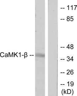 PNCK Polyclonal Antibody, Invitrogen 100 &mu;g; Unconjugated:Antibodies,