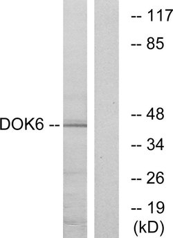 DOK6 Polyclonal Antibody, Invitrogen 100 &mu;g; Unconjugated:Antibodies