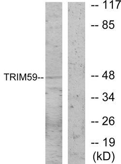 TRIM59 Polyclonal Antibody, Invitrogen 100 &mu;g | Buy Online | Invitrogen | Fisher Scientific