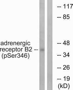 Phospho-beta-2 Adrenergic Receptor (Ser346) Polyclonal Antibody, Invitrogen 100 &mu;g | Buy Online | Invitrogen | Fisher Scientific