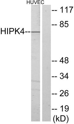 HIPK4 Polyclonal Antibody, Invitrogen 100 &mu;g | Buy Online | Invitrogen | Fisher Scientific