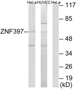 ZNF397 Polyclonal Antibody, Invitrogen 100 &mu;g; Unconjugated:Antibodies,