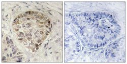 Phospho-CENTB1 (Ser554) Polyclonal Antibody, Invitrogen 100 &mu;g; Unconjugated:Antibodies,