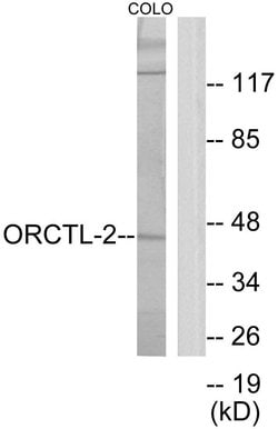 SLC22A18 Polyclonal Antibody, Invitrogen 100 &mu;g; Unconjugated:Antibodies,