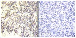 Phospho-p47phox (Ser328) Polyclonal Antibody, Invitrogen 100 &mu;g; Unconjugated:Antibodies,