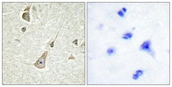 PCDH11Y Polyclonal Antibody, Invitrogen 100 &mu;g; Unconjugated:Antibodies,