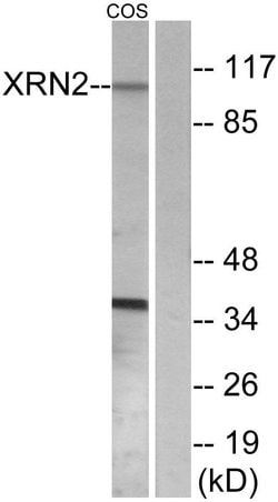 XRN2 Polyclonal Antibody, Invitrogen 100 &mu;g; Unconjugated:Antibodies,