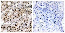 Phospho-PDCD4 (Ser457) Polyclonal Antibody, Invitrogen 100 &mu;g; Unconjugated:Antibodies,