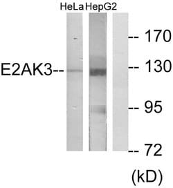 PERK Polyclonal Antibody, Invitrogen 100 &mu;g; Unconjugated:Antibodies,