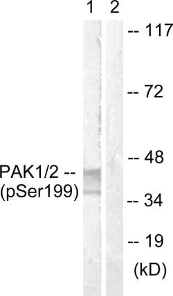 Phospho-TERT (Ser824) Polyclonal Antibody, Invitrogen 100 &mu;g; Unconjugated:Antibodies,