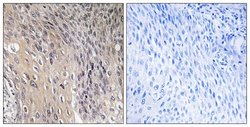 Phospho-RhoGDI (Ser174) Polyclonal Antibody, Invitrogen 100 μg; Unconjugated:Antibodies,