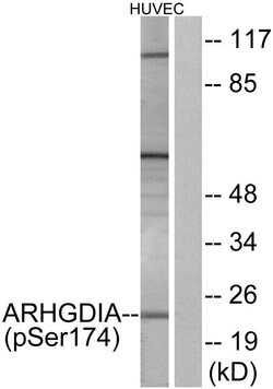 Phospho-RhoGDI (Ser174) Polyclonal Antibody, Invitrogen 100 μg; Unconjugated:Antibodies,