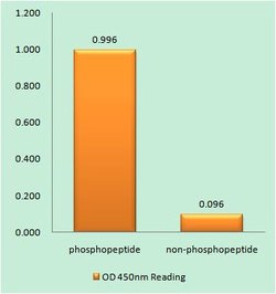 Invitrogen Phospho-Desmin (Ser60) Polyclonal Antibody 100 μg; Unconjugated:Antibodies,
