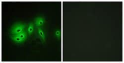Adenylate Cyclase 8 Polyclonal Antibody, Invitrogen 100 &mu;g; Unconjugated:Antibodies,