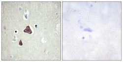 Adenylate Cyclase 8 Polyclonal Antibody, Invitrogen 100 &mu;g; Unconjugated:Antibodies,