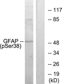 Phospho-GFAP (Ser38) Polyclonal Antibody, Invitrogen 100 &mu;g; Unconjugated:Anticuerpos