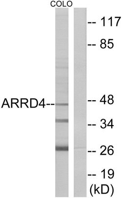 ARRDC4 Polyclonal Antibody, Invitrogen 100 &mu;g; Unconjugated:Antibodies,