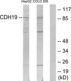 CDH19 Polyclonal Antibody, Invitrogen 100 &mu;g; Unconjugated:Antibodies,