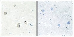 CDH22 Polyclonal Antibody, Invitrogen 100 &mu;g; Unconjugated:Antibodies,