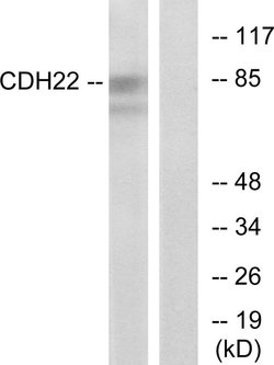 CDH22 Polyclonal Antibody, Invitrogen 100 &mu;g; Unconjugated:Antibodies,