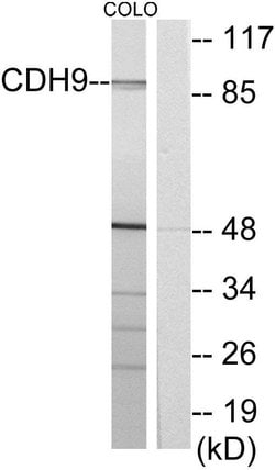 CDH9 Polyclonal Antibody, Invitrogen 100 &mu;g | Buy Online | Invitrogen | Fisher Scientific