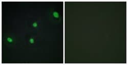 CDCA4 Polyclonal Antibody, Invitrogen 100 &mu;g; Unconjugated:Antibodies,