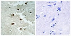 CDCA4 Polyclonal Antibody, Invitrogen 100 &mu;g; Unconjugated:Antibodies,