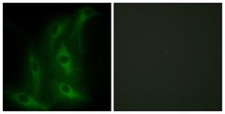 COL4A6 Polyclonal Antibody, Invitrogen 100 &mu;g; Unconjugated:Antibodies,