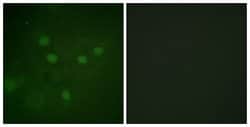 Phospho-NFAT5 (Ser1197) Polyclonal Antibody, Invitrogen 100 &mu;g; Unconjugated:Antibodies,
