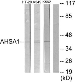 COL9A2 Polyclonal Antibody, Invitrogen 100 &mu;g; Unconjugated:Antibodies,