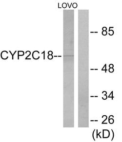 Cytochrome P450 Pan Polyclonal Antibody, Invitrogen 100 &mu;g | Buy Online | Invitrogen | Fisher Scientific