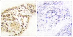 Phospho-Vimentin (Ser83) Polyclonal Antibody, Invitrogen 100 &mu;g; Unconjugated:Antibodies,