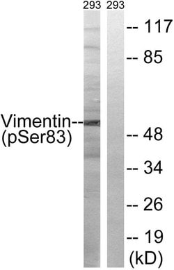 Phospho-Vimentin (Ser83) Polyclonal Antibody, Invitrogen 100 &mu;g; Unconjugated:Antibodies,