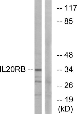 IL20RB Polyclonal Antibody, Invitrogen 100 &mu;g; Unconjugated:Antibodies,