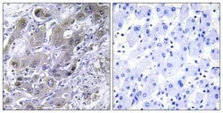 MRPS18A Polyclonal Antibody, Invitrogen 100 μg; Unconjugated:Antibodies,