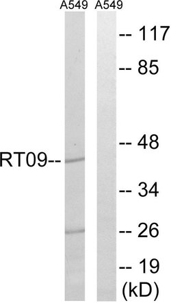 MRPS9 Polyclonal Antibody, Invitrogen 100 &mu;g; Unconjugated:Antibodies,