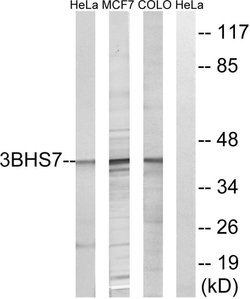HSD3B7 Polyclonal Antibody, Invitrogen 100 &mu;g; Unconjugated:Antibodies,