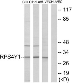 RPS4Y1 Polyclonal Antibody, Invitrogen 100 &mu;g; Unconjugated:Antibodies
