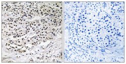 CEP131 Polyclonal Antibody, Invitrogen 100 &mu;g; Unconjugated:Antibodies,