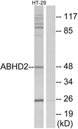 ABHD2 Polyclonal Antibody, Invitrogen 100 &mu;g | Buy Online | Invitrogen | Fisher Scientific