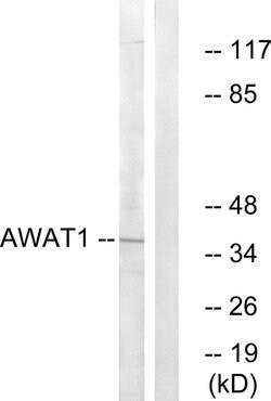 AWAT1 Polyclonal Antibody, Invitrogen 100 μg; Unconjugated:Antibodies,