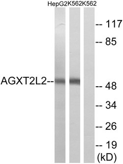 PHYKPL Polyclonal Antibody, Invitrogen 100 &mu;g; Unconjugated:Antibodies,