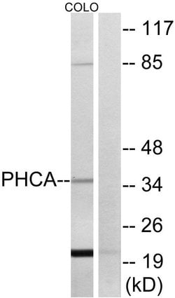 ACER3 Polyclonal Antibody, Invitrogen 100 &mu;g; Unconjugated:Antibodies,
