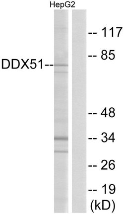 DDX51 Polyclonal Antibody, Invitrogen 100 &mu;g; Unconjugated:Antibodies,