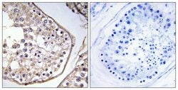 BAGE3 Polyclonal Antibody, Invitrogen 100 &mu;g; Unconjugated:Antibodies,