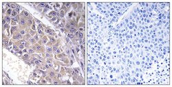 B4GALT3 Polyclonal Antibody, Invitrogen 100 μg; Unconjugated:Antibodies,