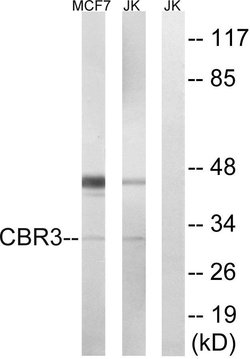 CBR3 Polyclonal Antibody, Invitrogen 100 &mu;g; Unconjugated:Anticuerpos