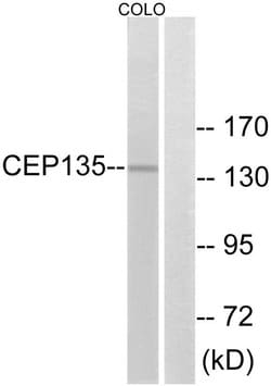 CEP135 Polyclonal Antibody, Invitrogen 100 &mu;g; Unconjugated:Antibodies,