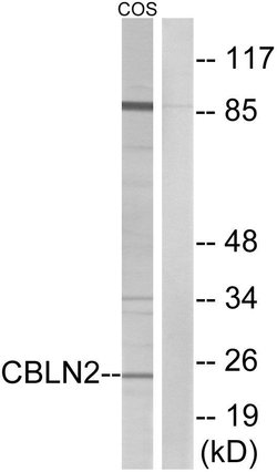 Cerebellin 2 Polyclonal Antibody, Invitrogen 100 &mu;g | Buy Online | Invitrogen | Fisher Scientific