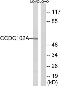 CCDC102A Polyclonal Antibody, Invitrogen 100 &mu;g; Unconjugated:Antibodies,